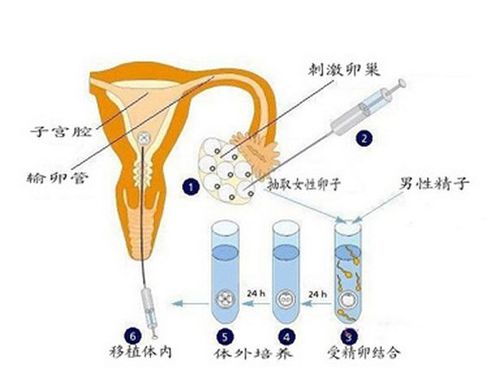 供卵生的孩子和自己有血缘吗(供卵生孩子，是否有血缘关系？)