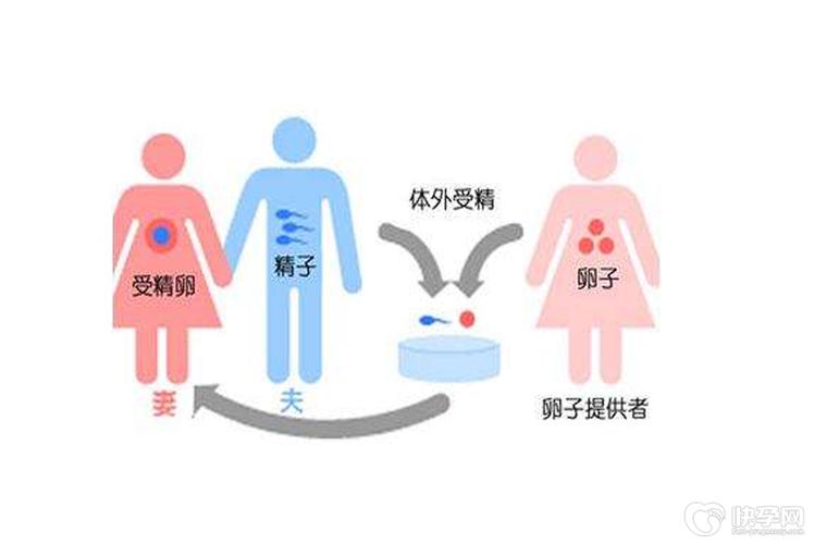 供卵试管代怀方法(供卵试管代怀：新生育方法解析)