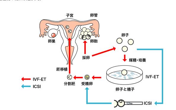 供卵和试管有什么区别(供卵与试管婴儿有什么区别？)